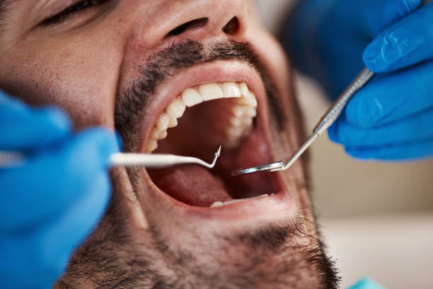 Best Broken or Chipped Tooth Repair in Marshfield, MO